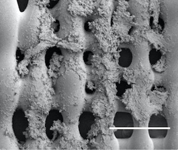 Rice Uni Bone Cancer                3D printing has enabled the researchers to get closer than ever to mimicking the architecture of real bone. - Mikos Research Group/ Rice University