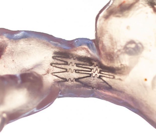 Nate Yamane pulmonary artery      Using CT scans of Nate’s heart, the team produced a 3D-printed model of the obstructed region of the heart.