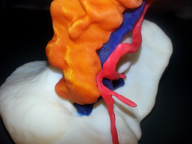 Uni of Pavia surgical model - Stratasys      For years, the University of Pavia relied solely on the skill and judgement of its surgeons, but the emergence of 3D technology has seen the sc...