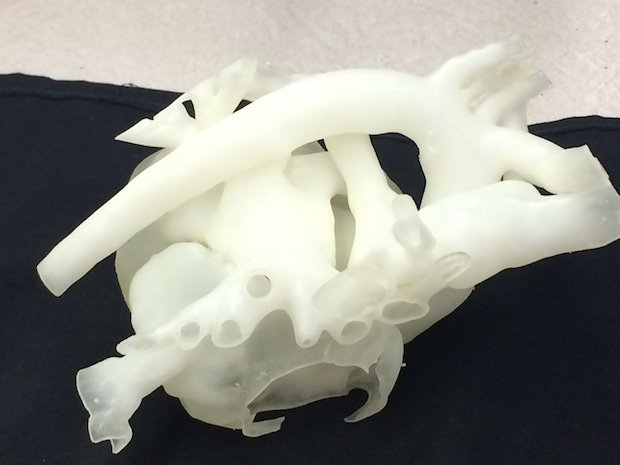 Stratasys 3DHEART      "3D-printed patient-specific models improve surgery, improve outcomes and result in lower treatment costs" - Dr Yoav Dori, Children's Hospital of Philadelphia.