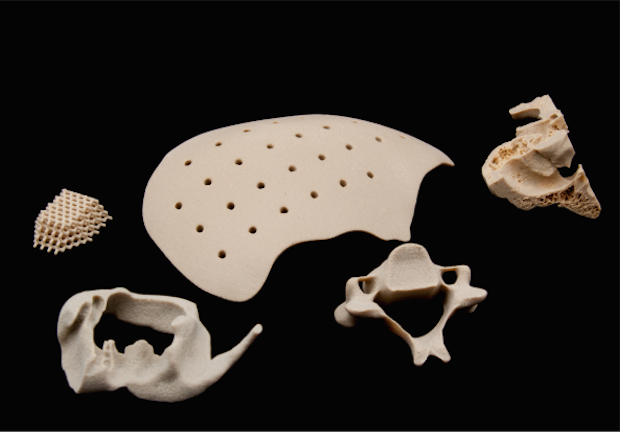 OPM OsteoFab implants      Originally filed in December 2011, the patented 'Customized Implant for Bone Replacement' method leverages OPM’s OsteoFab implant manufacturing process. - Oxford...