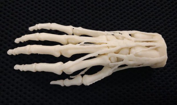 Stratasys network 3D printing hospital      3D printed hand model for teaching, diagnosis, procedural planning. Digital file is a VA resource, hospitals can request models 3D printed on ne...