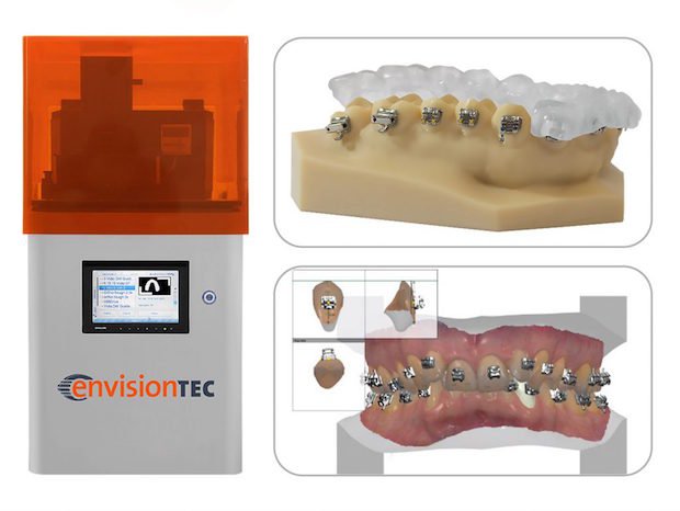 EnvisionTEC E-IDB IDS 2017      Using the E-IDB material in an EnvisionTEC Vida 3D printer, four custom trays can be built in 45 minutes, with little-to-no need for post processing.