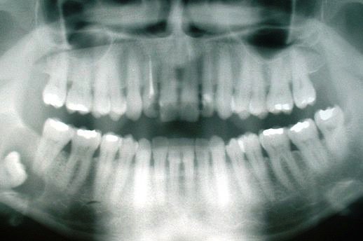 Scheu Dental announce digital orthodontic collaboration