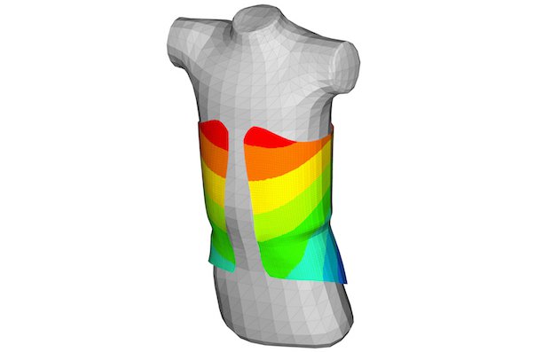 Simulating the deflection of the torso brace in Altair HyperWorks.jpg