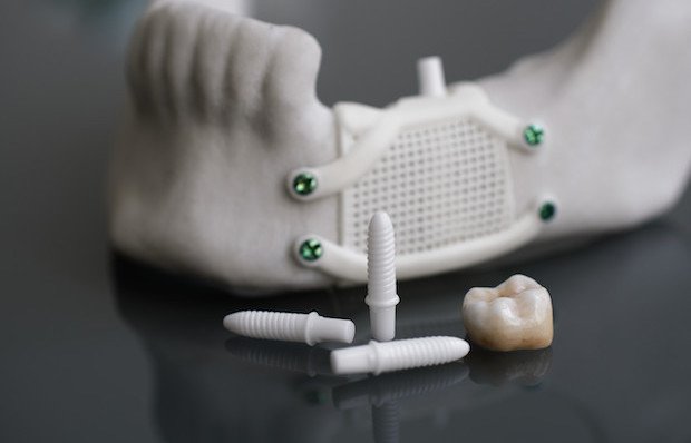Ceramic - Dental 3D printing.jpg