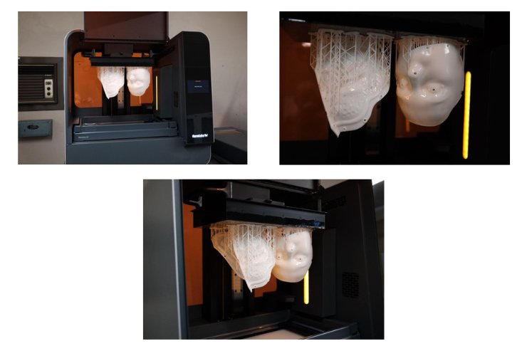 Experimentation with Rigid 10K Resin and Form 3L 3D printer to make prosthetic make-up moulds