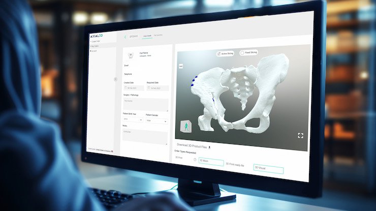 Axial3D and GE HealthCare to combine segmentation & imaging technologies for 3D printed patient-specific outputs