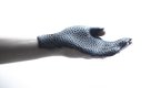 3D printed orthotics with CRP's Windform laser sintering material
