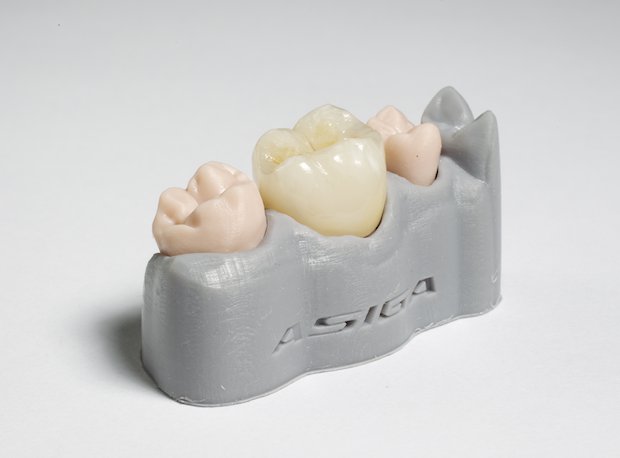 asiga-dental model.png