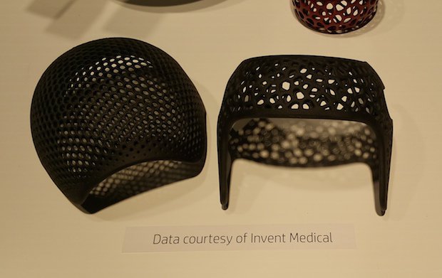 Invent Medical put the company on hold in order to wait for HP's 3D Printing solution.jpg