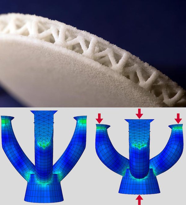 3D printed shoe insole