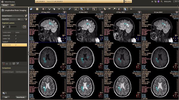 IntelliSpace Portal 9.0 Brain Imaging 2